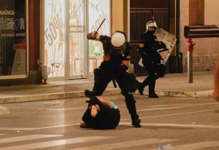 Му откажале бубрезите на момчето што полицијата го тепаше во Ваљево